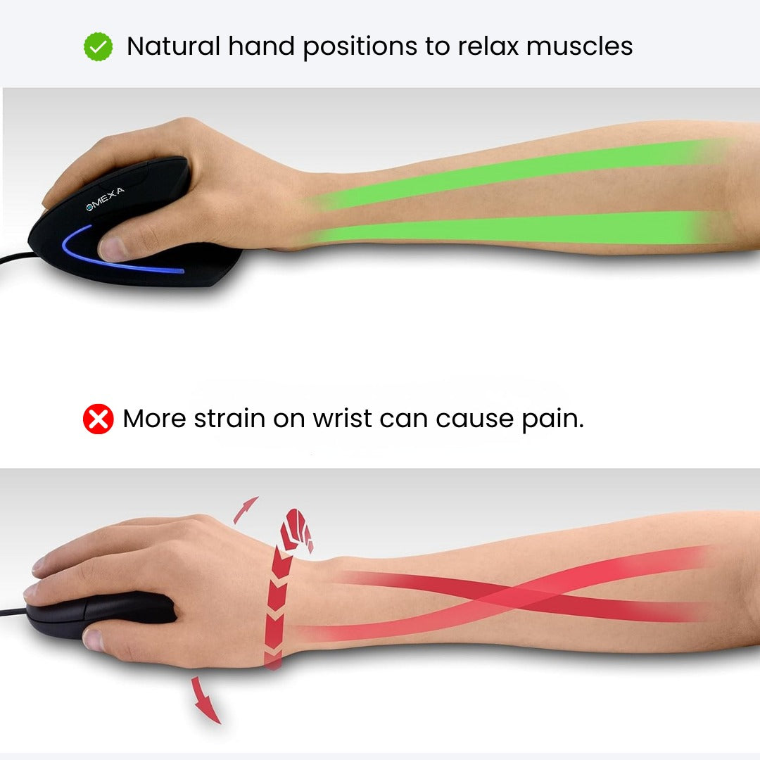 Omexa™ FlowGrip